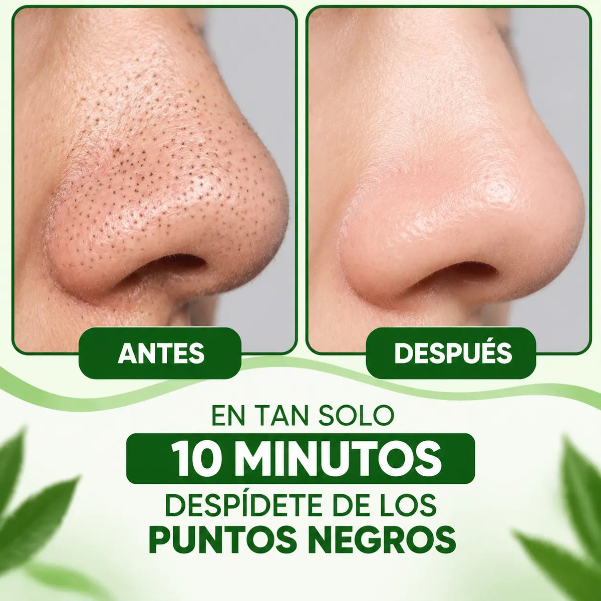 LANBENA | Limpieza avanzada de poros y puntos negros
