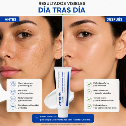 Dr. Melaxin TX Brightening Cream - Ayuda a mejorar manchas, imperfecciones y tono desigual para lucir una piel más clara y luminosa.