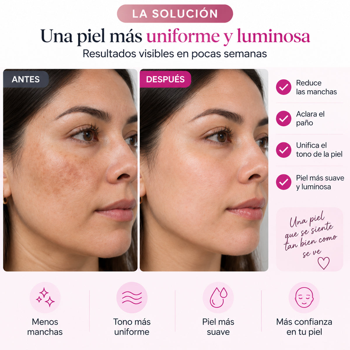 Crema para el Paño · Arbutina 7% + Tranexámico 4%