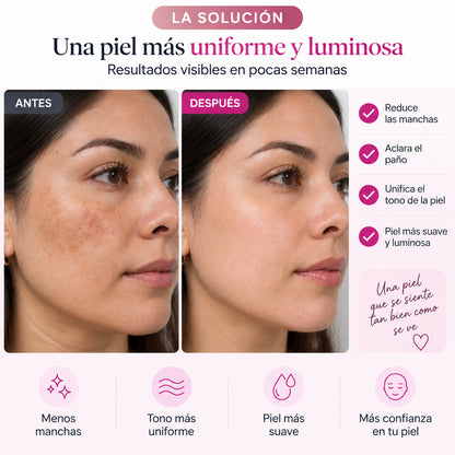 Crema para el Paño · Arbutina 7% + Tranexámico 4%